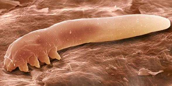 eyelid-mites-may-cause-eyebrows-to-itch